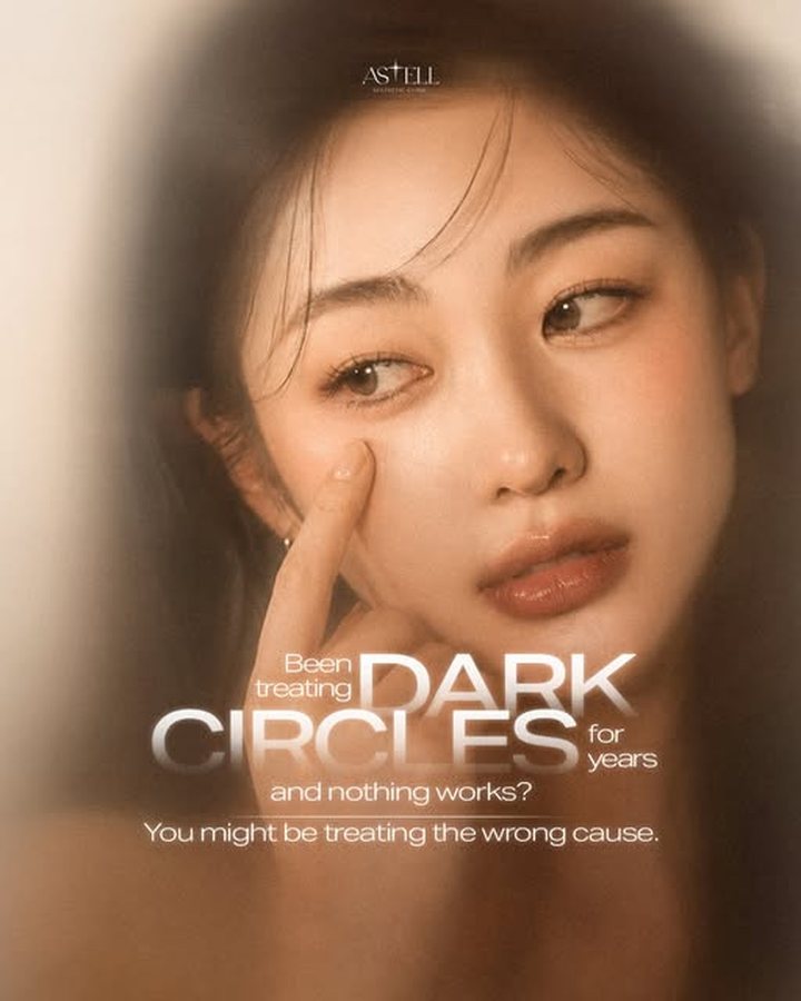 Treating dark circles — you may be treating the wrong cause