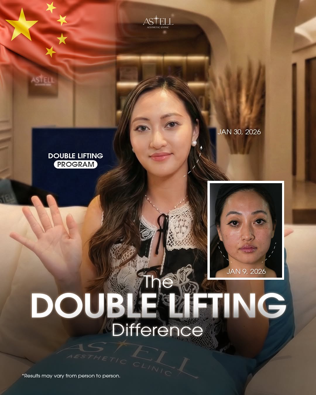 Patient from China — double lifting result