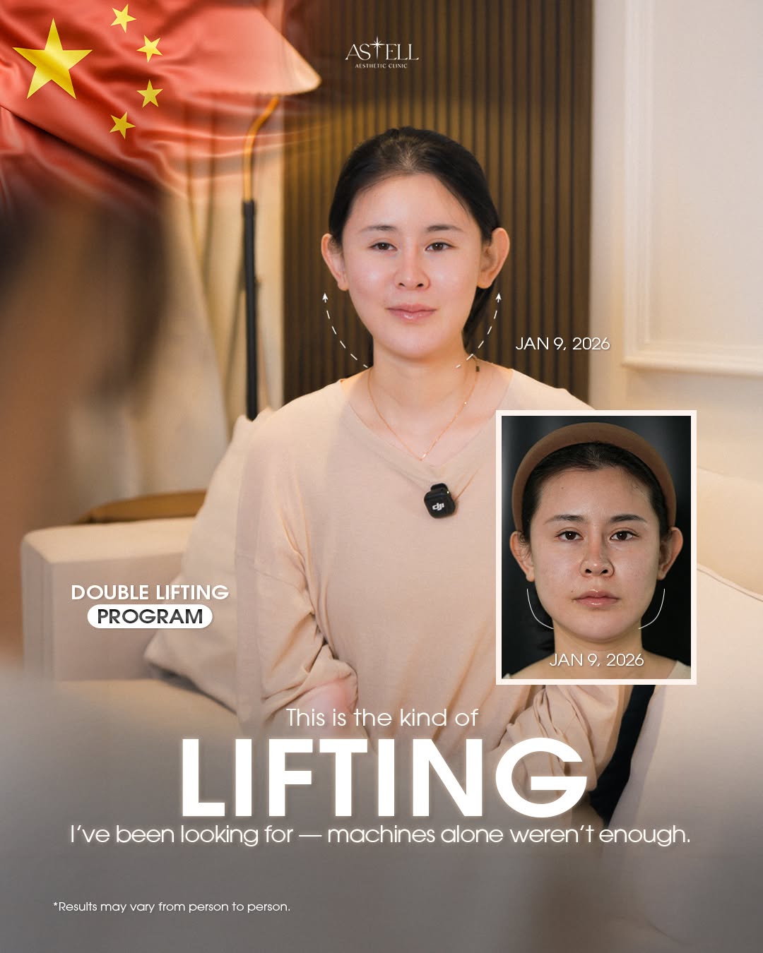 Patient from China — lifting result