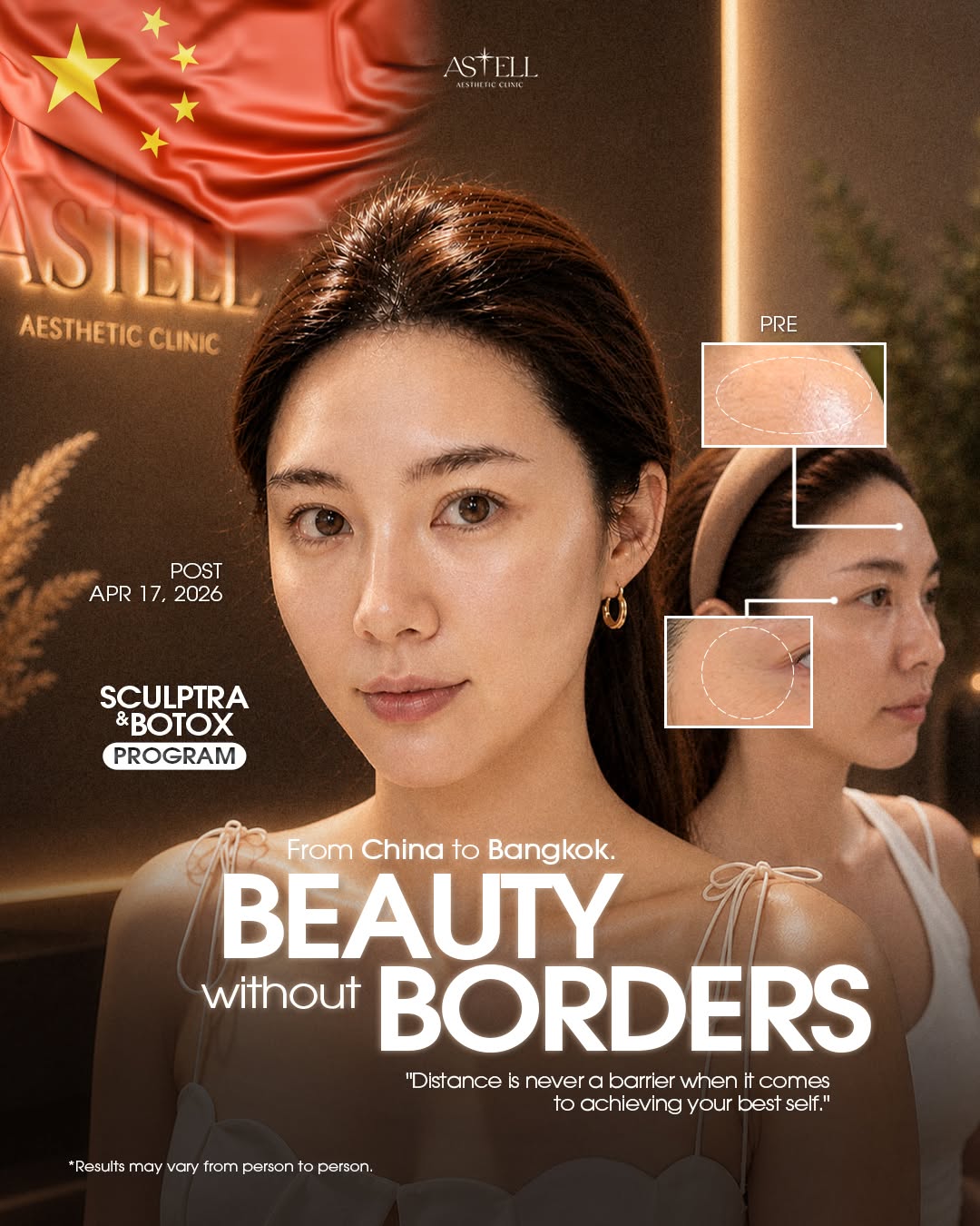 Patient from China — beauty without borders, before and after