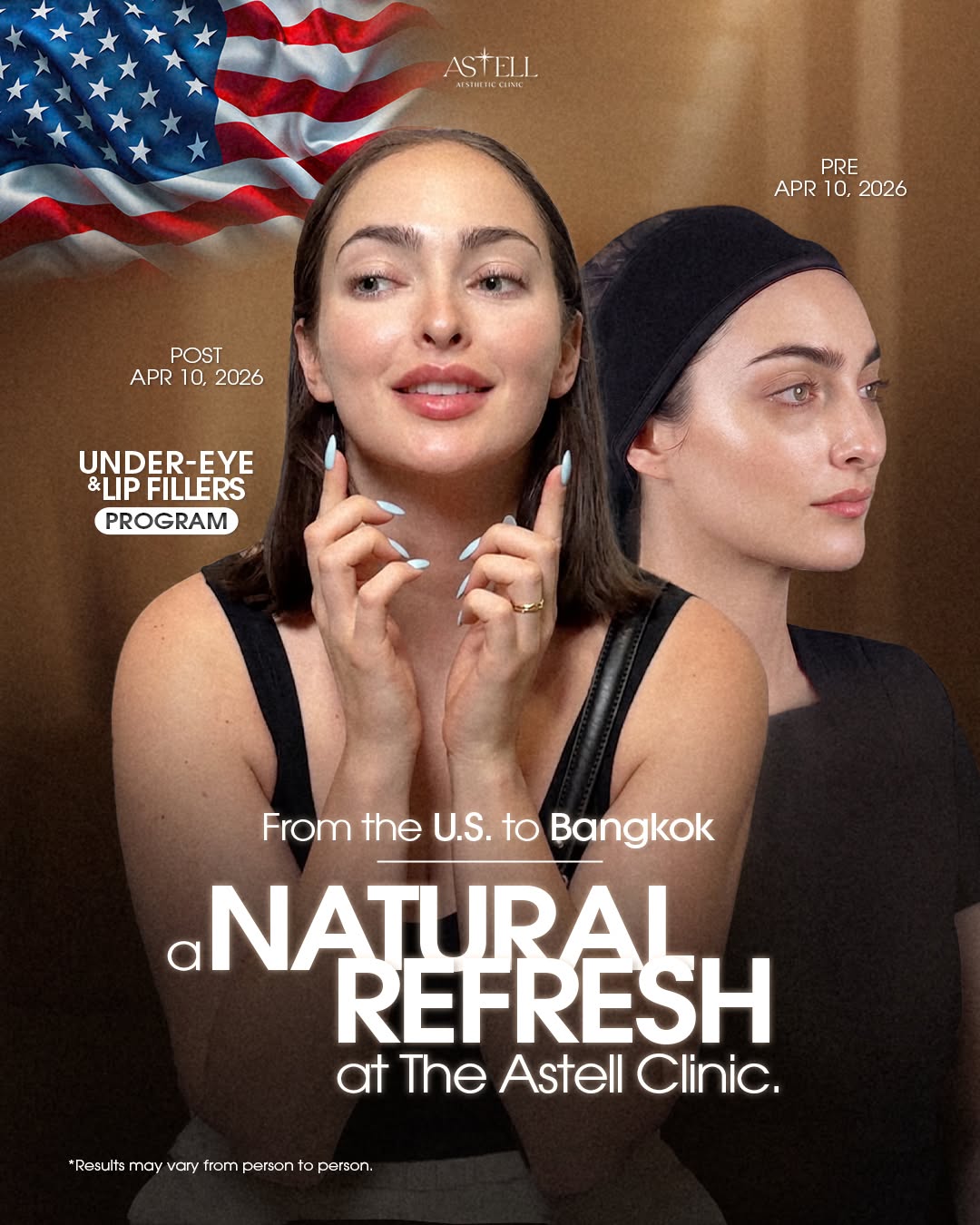 Patient from the United States — natural refresh, before and after