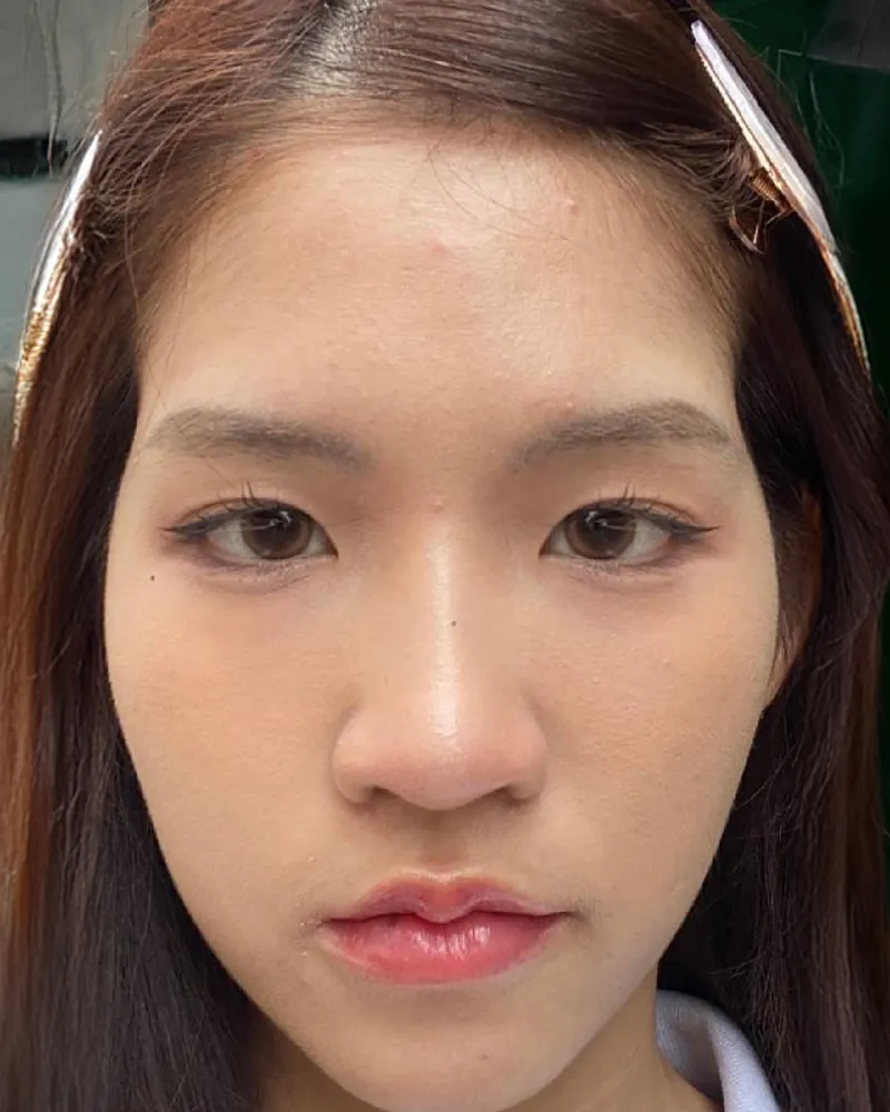Douyin Style &mdash; before