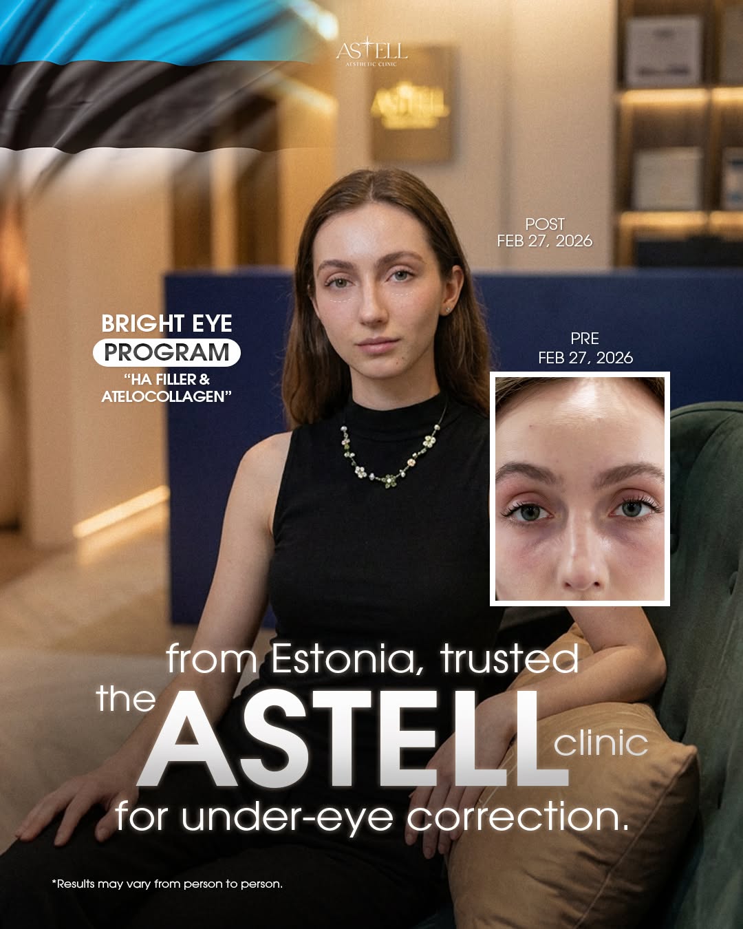 Under-Eye Correction result — Estonia